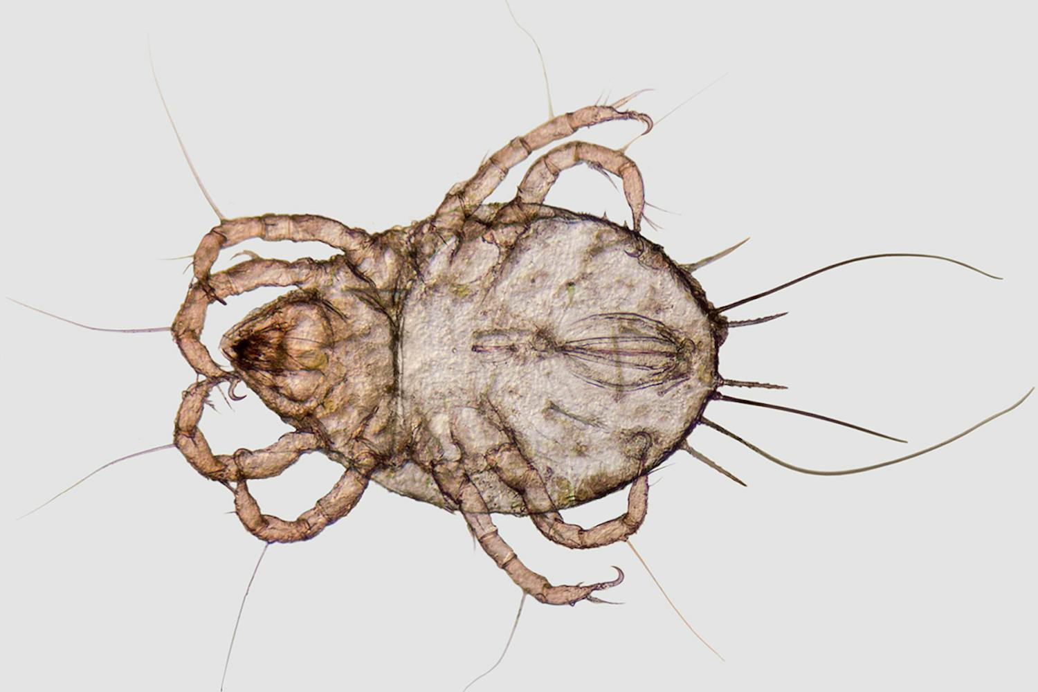 Hvad er husstøvmider? Kan man se husstøvmider?